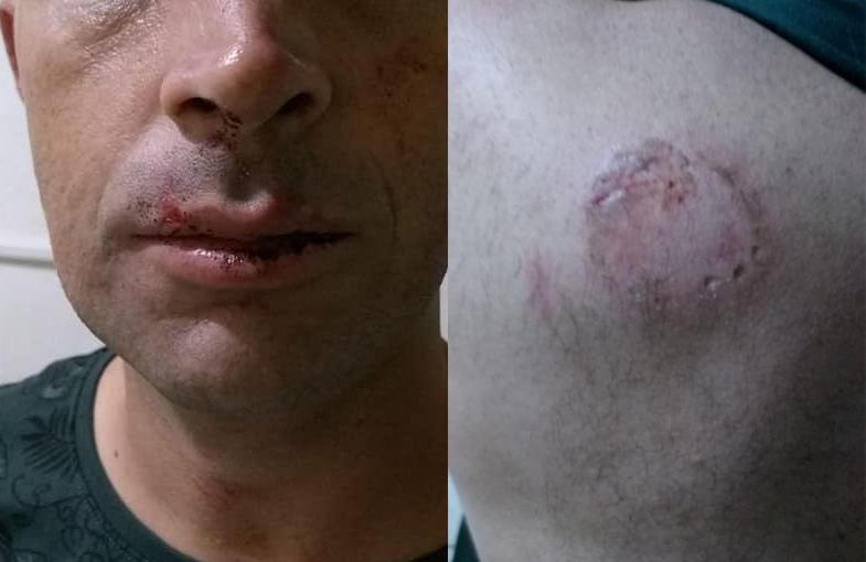 Suspeito do crime e a mordida nas costas do Taxista - Fábio Matavelli / Repórter Sassá